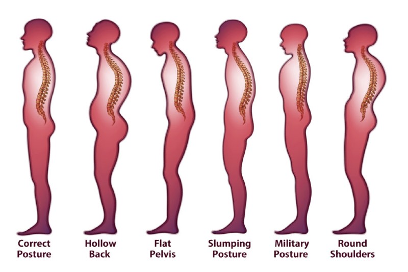 closed posture body language